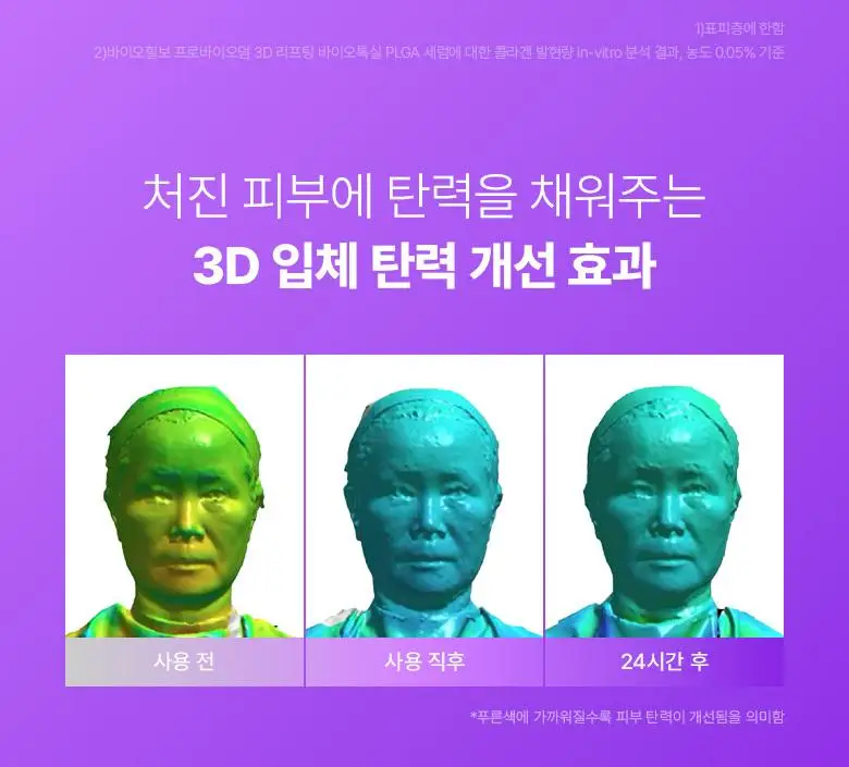 [녹는실|실프팅] 바이오힐보 프로바이오덤 3D 리프팅 바이오톡실 PLGA 세럼 30ml 상세페이지 13
